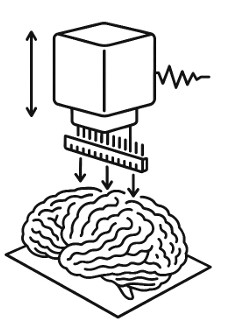 This patented innovation1 enables the high-resolution electrical 
characterization of the features of biological samples in two dimensions (2D 
map), with minimal sample preparation, under mild water-based conditions. 
The core idea is simple yet powerful: 
It becomes possible to obtain a spatial map of tissue permittivity and 
conductivity under a liquid water-like mediator, meaning the biological material 
can remain almost untreated and close to its natural state. 
Key capabilities 
 Detects variations in tissue electrical properties, reflecting the 
physiological function and composition, structure and conformation. 
 Works on tissues, membranes, skin, biofilms and other soft biological 
samples. 
 Operates under water-like conditions, no staining or sputtering/coating 
required. 
 Generates 2D maps of electrical properties across the surface of 
biological samples. 
 Designed for use beyond the laboratory. 
The illustration is symbolic and meant to inspire,
rather than depict precise details.
 Delivers high throughput and dependable performance even in harsh environments with its robust design. 
 Resolution in the order of several tens or hundreds of micrometers, ideal for fast biological applications. 
Why it matters 
While existing techniques delivering an image of spatial resolution can measure surface roughness, biochemical or 
optical properties, this invention provides a complementary physical dimension, i.e., electrical information. 
This opens opportunities for: 
 studying tissue heterogeneity, 
 detecting structural abnormalities, 
 comparing healthy vs altered regions, 
 analyzing the organization of cells in biofilms and on surfaces. 
Prototype status 
The patented technology can be easily integrated into commercially available devices, the scan head has been validated 
in laboratory tests and it has delivered stable electrical contrast under liquid using brain tissue as sample. Data 
acquisition is compatible with standard surface scanning instrumentation.